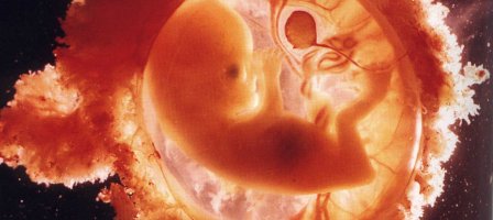 Prions pour la grâce d'un enfant pour Audrey et Damien